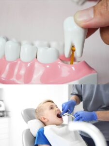 Tooth/teeth extraction