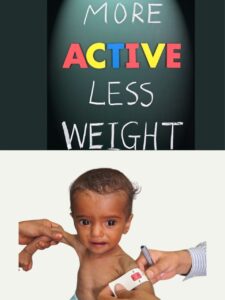 Underweight Treatment for Children - AV Children and Multispecialty Clinic