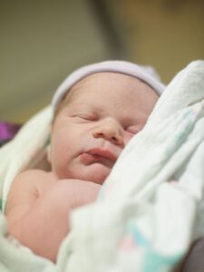 Newborn Jaundice - pediatric service